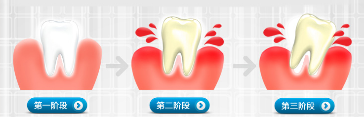 第一次洗牙有多疼？